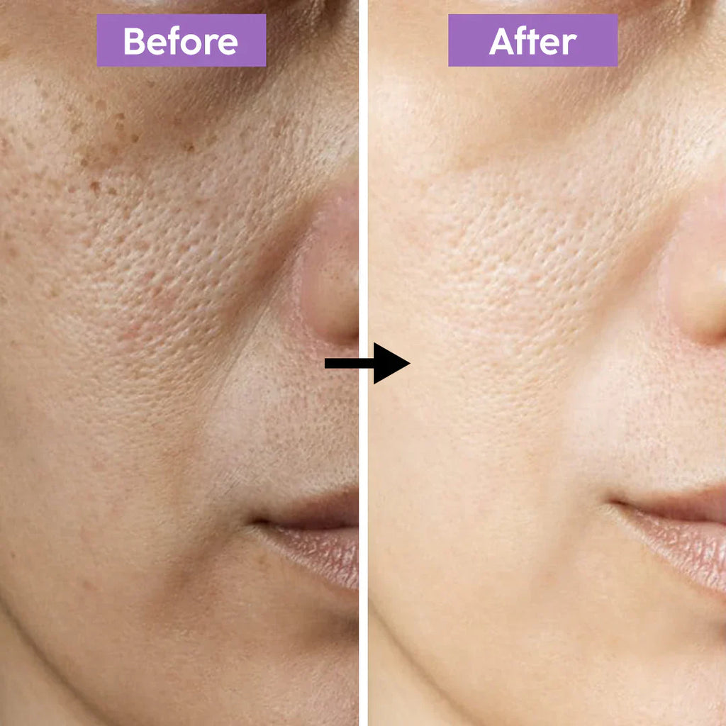 Lift Me Up Collagen Jelly Cream | Immediate Tightening Effect | Collagen & Multi-Peptide Firming Cream