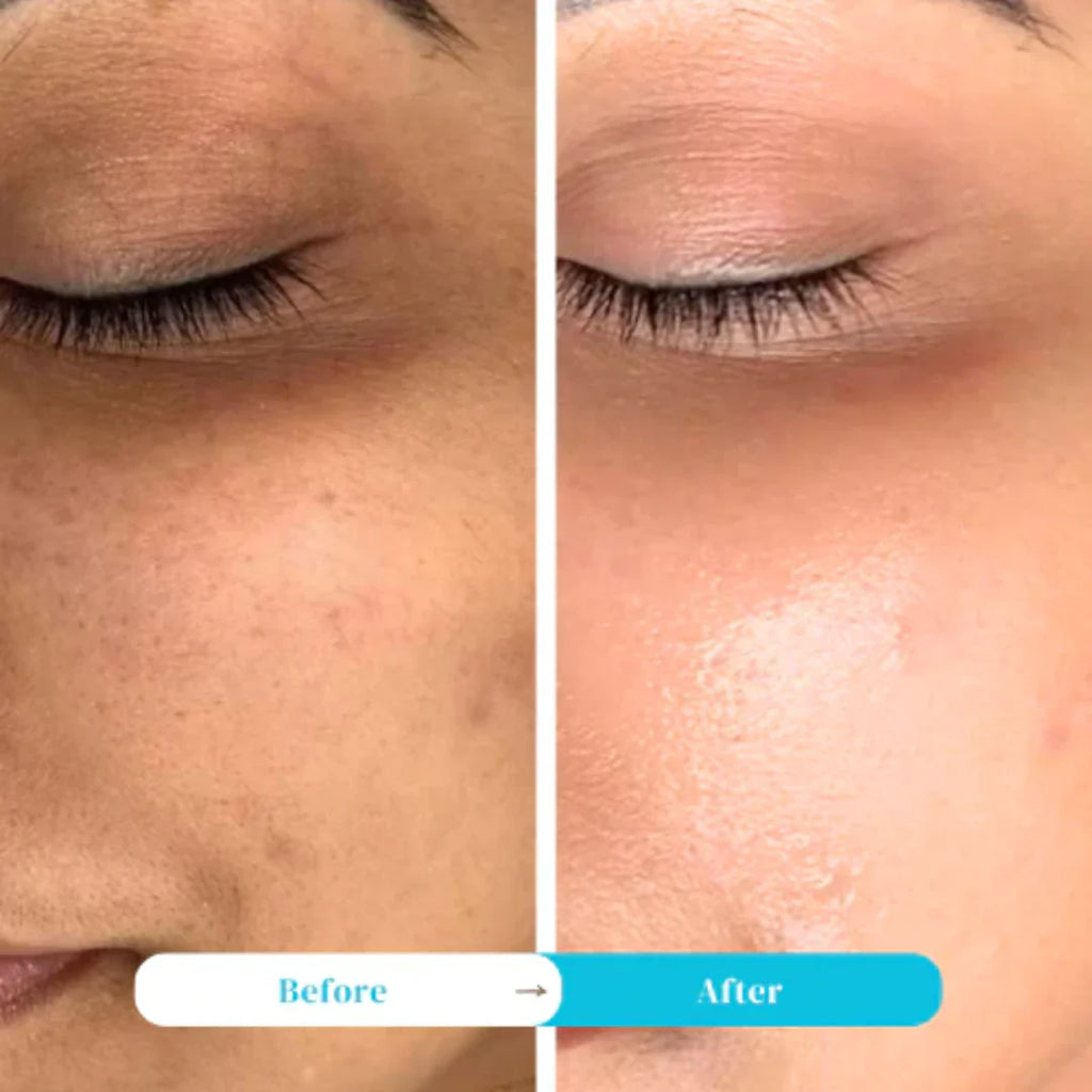 Lift Me Up Collagen Jelly Cream | Immediate Tightening Effect | Collagen & Multi-Peptide Firming Cream