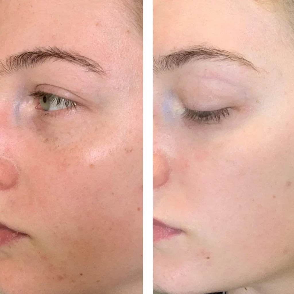 Lift Me Up Collagen Jelly Cream | Immediate Tightening Effect | Collagen & Multi-Peptide Firming Cream